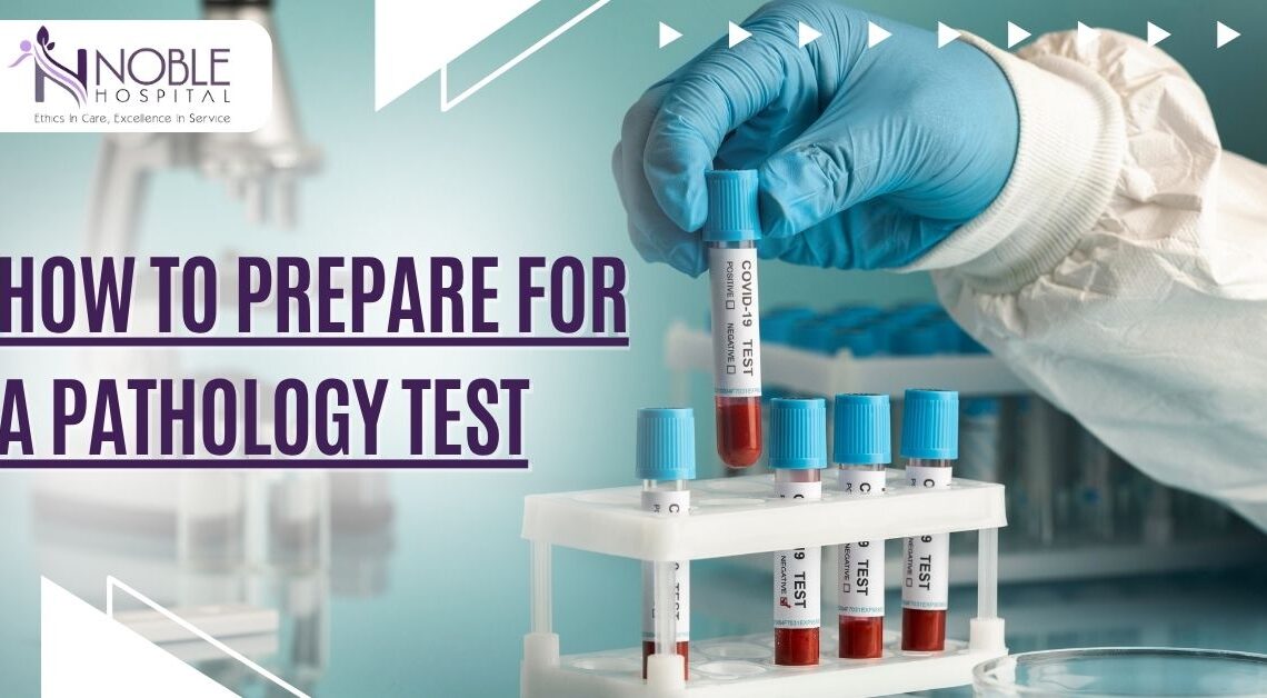 Pathology test preparation
Preparing for blood test
Fasting before blood test
Medical test preparation tips
Hospital in Sonipat
Noble Hospital Sonipat
Sonipat pathology lab
What to avoid before a blood test
Blood test fasting rules
How to prepare for urine test
Diagnostic tests in Sonipat
Pathology services in Sonipat