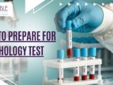 Pathology test preparation Preparing for blood test Fasting before blood test Medical test preparation tips Hospital in Sonipat Noble Hospital Sonipat Sonipat pathology lab What to avoid before a blood test Blood test fasting rules How to prepare for urine test Diagnostic tests in Sonipat Pathology services in Sonipat