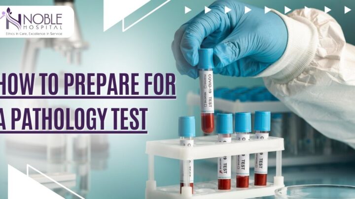 Pathology test preparation Preparing for blood test Fasting before blood test Medical test preparation tips Hospital in Sonipat Noble Hospital Sonipat Sonipat pathology lab What to avoid before a blood test Blood test fasting rules How to prepare for urine test Diagnostic tests in Sonipat Pathology services in Sonipat